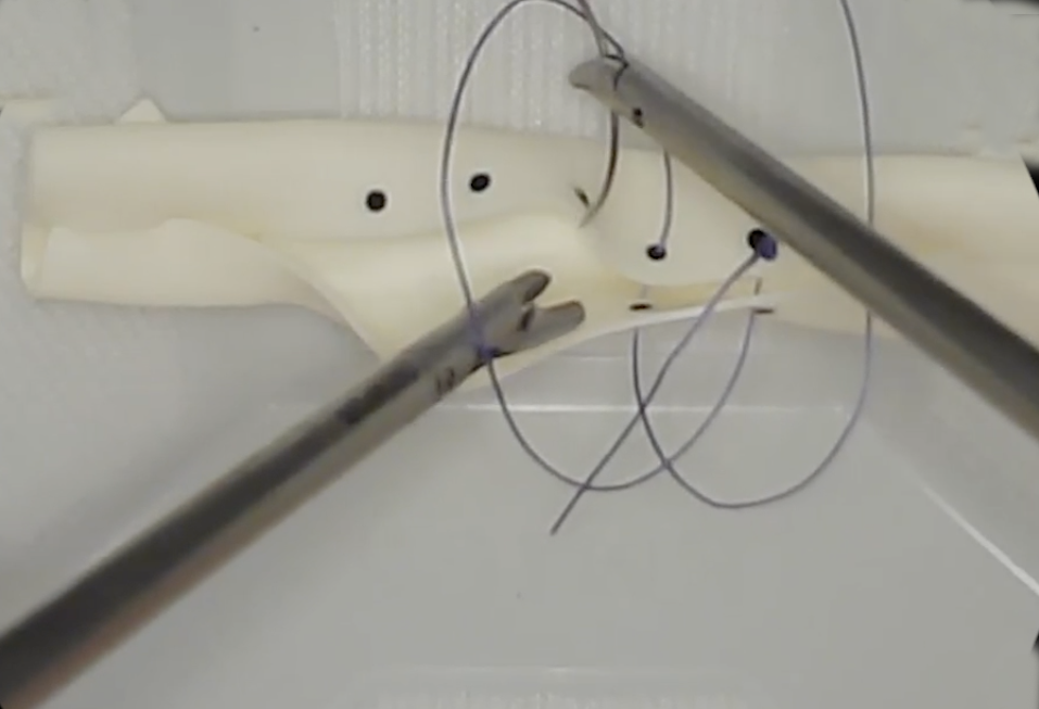 EMIGS L5 - Running Stitch