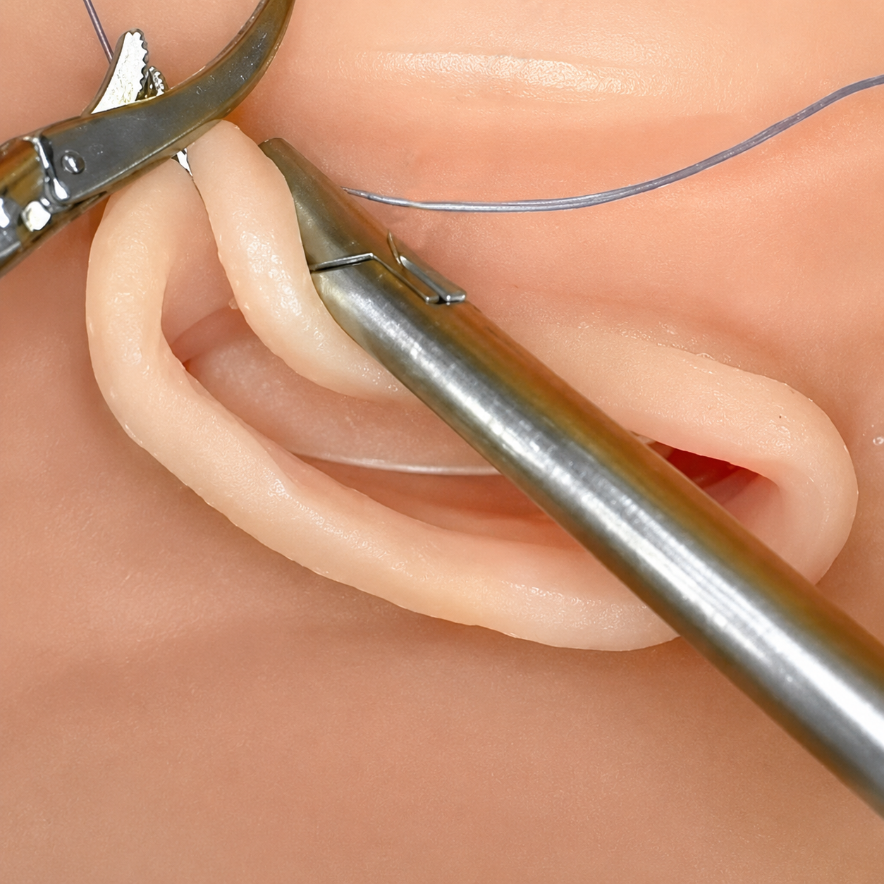 Vaginal Vault Closure